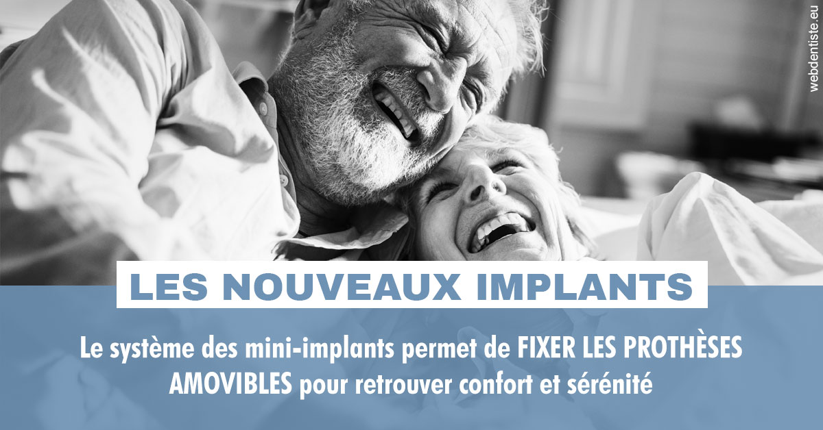 https://dr-assayag-nadine.chirurgiens-dentistes.fr/Les nouveaux implants 2