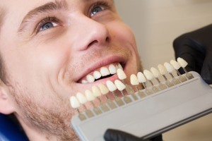 1 - Les facettes dentaires céramiques à Paris