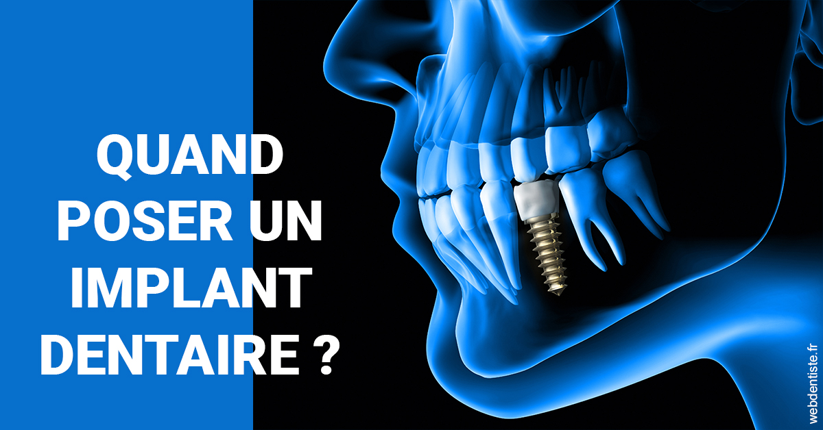https://dr-assayag-nadine.chirurgiens-dentistes.fr/Les implants 1