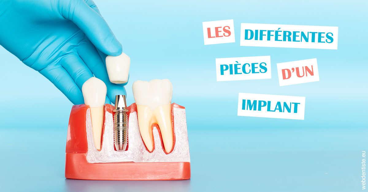 https://dr-assayag-nadine.chirurgiens-dentistes.fr/Les différentes pièces d’un implant 2