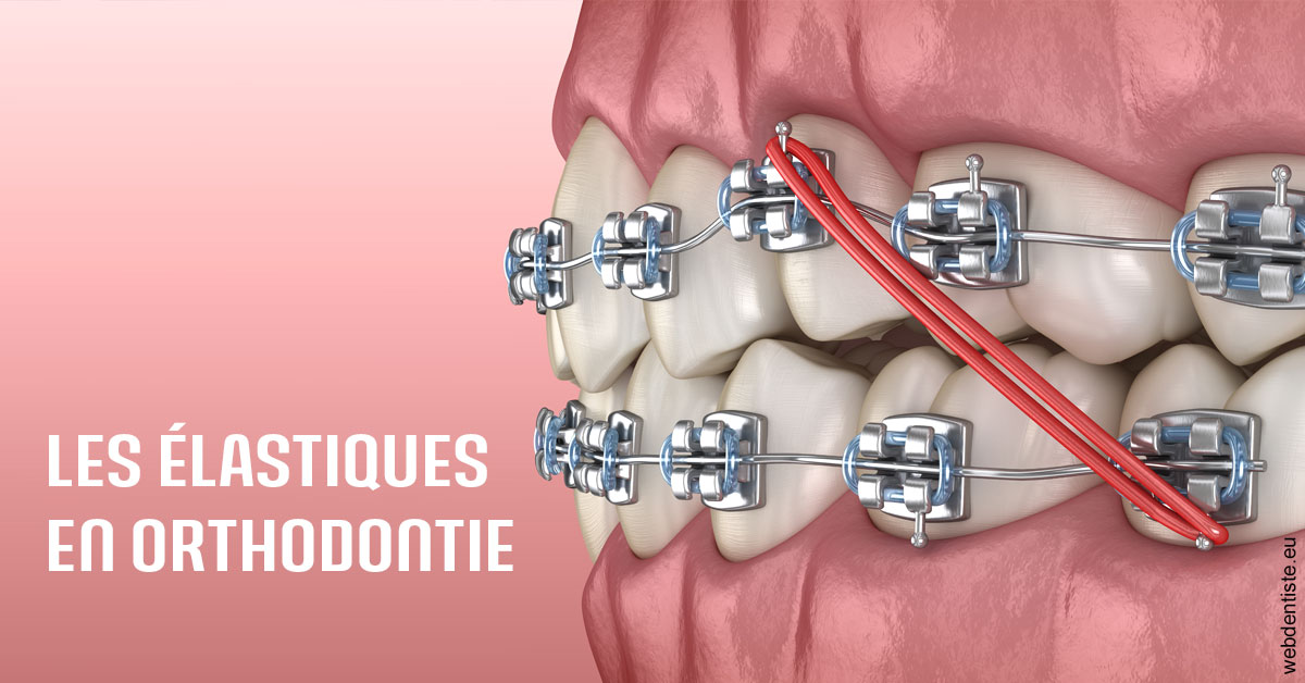 https://dr-assayag-nadine.chirurgiens-dentistes.fr/Elastiques orthodontie 2