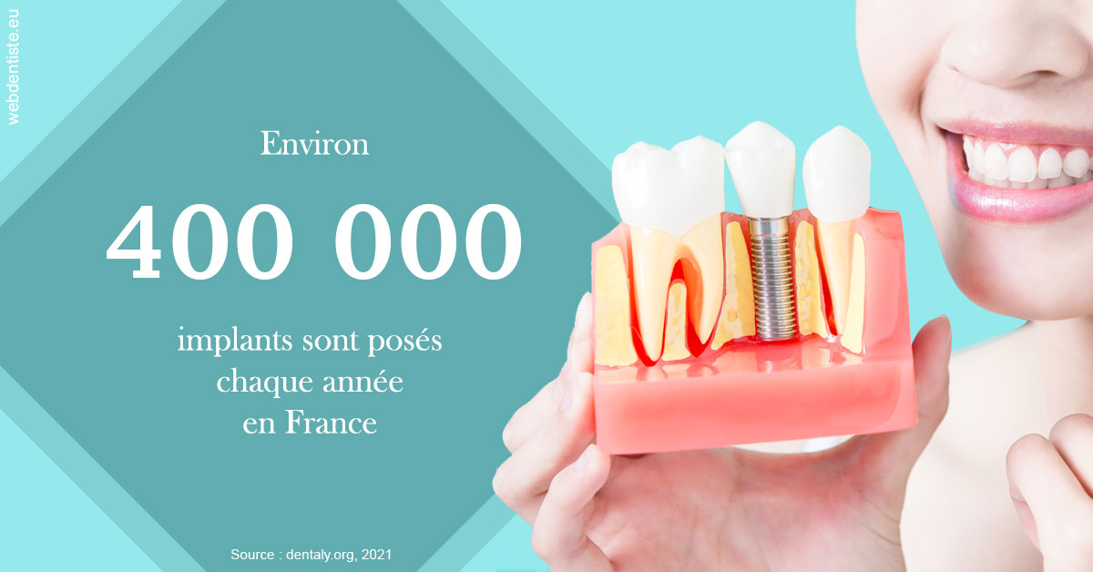 https://dr-assayag-nadine.chirurgiens-dentistes.fr/Pose d'implants en France 2
